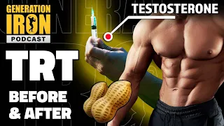 Before & After Using TRT: Pros & Cons Of Testosterone Replacement Therapy | GI Podcast