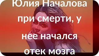 Юлия Началова при смерти, у нее начался отек мозга