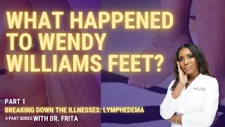 What Happened To Wendy Williams Feet? Breaking Down Lymphedema [Part 1]