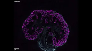 Dr Julie Moreau's timelapse movie of kidney development - Monash University