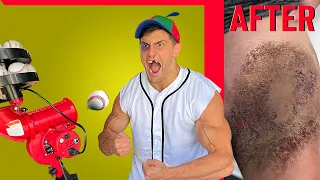 Creating the WORST BASEBALL INJURY of all Time | Bodybuilder VS Pitching Machine Experiment