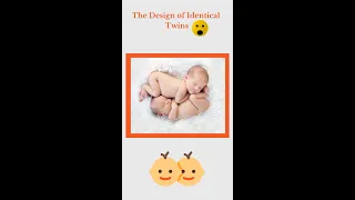 The Design of Identical Twins 🥰| How Twins Are Formed 😲 #shorts