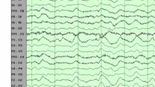 EEG basics