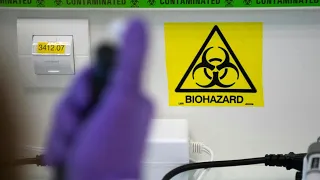 Affenpocken: Wie gefährlich ist das Virus? | AFP