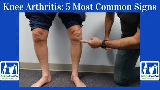 Knee Arthritis- 5 Most Common Signs You Have It!