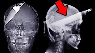 Top 15 Mysterious Things Found by X-Ray