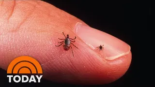 New Lyme Disease Vaccine Enters Final Phase: What To Know