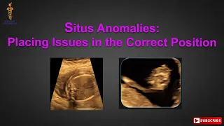 Situs Anomalies: Placing Issues in the Correct Position