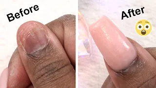 MY Real Nail Came OFF! - Here's How I Fixed It!