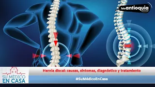 #SuMédicoEnCasa, Hernia discal: causas, diagnóstico y tratamiento - Teleantioquia