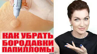 Нашла крутое средство от бородавок и папиллом за копейки!