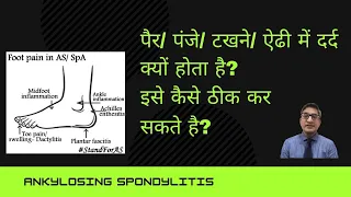 पैर/ पंजा/ टखने/ ऐढी में दर्द क्यों होता है?