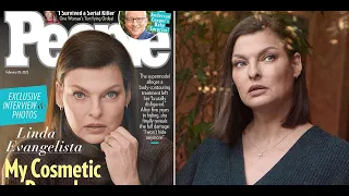 Linda Evangelista Shares First Photos of Her Body Since Fat Freezing