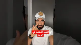 النقط الدهنية في الوجه