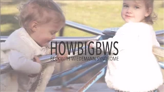 Beckwith-Wiedemann Syndrome - What is BWS?