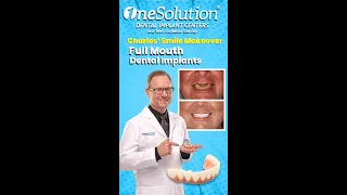 Full Mouth Dental Implants Smile Journey