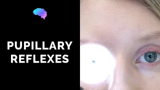 Pupillary Reflexes - OSCE Guide (Clip)