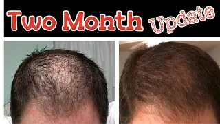 Update - Best Hair Loss Treatment - Shampoo and Conditioner - Hair Loss Prevention Remedies