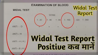 Typhoid Blood Test | Widal Test Report Reading | Widal Test In Hindi | Widal Test Report Kaise Dekhe