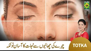 Zubaida Apa Totkay | How To Get Rid Of Freckles | Jild K Dagho ka ilaj | Skin Care Tips | MasalaTv