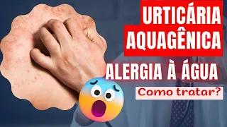 URTICÁRIA AQUAGÊNICA: DESVENDANDO UMA CONDIÇÃO INTRIGANTE (CAUSAS, SINTOMAS E COMO TRATAR)