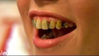 How To Stain Your Teeth With Fleet Street Pegworks Tooth Lacquers