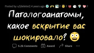 ПАТОЛОГОАНАТОМЫ в шоке от ТАКИХ причин смерти☠️