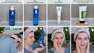 How to use La Roche Posay Effaclar 3-Step Kit | Routine for Oily Skin