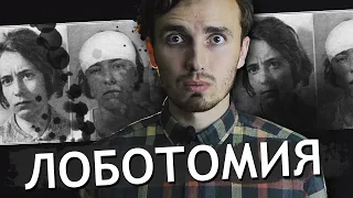 Лоботомия - [История Медицины]