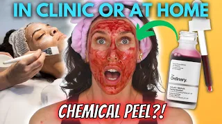 Chemical Peels: 3 Surprising Things That Happen When You Get Chemical Peels