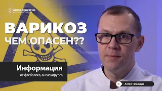 Чем опасен варикоз? Какие бывают осложнения варикоза?