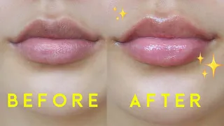 ✨Lip Care 101 • How to get rid of Chapped Lips