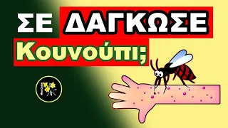 Σε Δάγκωσε Κουνούπι;   Σπιτικές Θεραπείες & Αλλα Χρήσιμα & Σχετικά