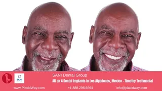 SANI Dental Group - All on 4 Dental Implants in Los Algodones, Mexico - Timothy Testimonial