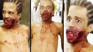 GRAPHIC! DEMON POSSESSED BRAZILIAN MAN ATTACKS PEOPLE IN HOSPITAL!