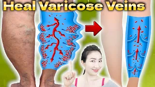 1 Minute Shaking Legs Before Sleep will Remove Swelling and Pain of Varicose Veins