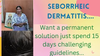 how to solve  seborrheic dermatitis in tamil|Shriya Health Care