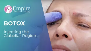 Botox Forehead Injections—The Glabellar