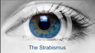 The Strabismus 1( EOM +Ocular Motility)