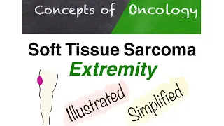 Extremity soft tissue sarcoma