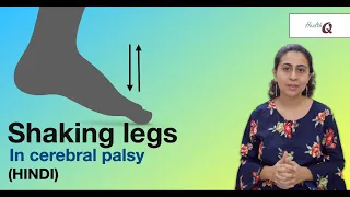 पैर का कंपन I CEREBRAL PALSY I SHAKY LEGS IN CEREBRAL PALSY KIDS