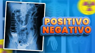 CONTRASTE POSITIVO VS CONTRASTE NEGATIVO NA RADIOLOGIA