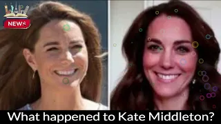 Kate Middleton's Mystery Surgery: What Happened to the Future Queen?