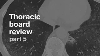Board Review | Thoracic Radiology | Part 5
