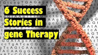 Gene Therapy - 6 stories for patients with genetic disease