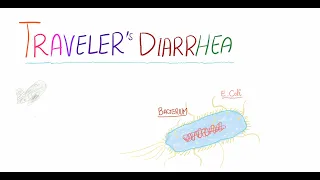 Traveler's Diarrhea | definition, causes, clinical findings, diagnosis, prevention and management