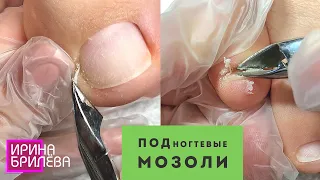 Педикюр 🌸 Подробное вычищение подногтевых мозолей 🌸 Обработка пальцев ног 🌸 Домашний педикюр