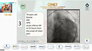 CINE7 Evidence behind deferred stenting of culprit  and staged stenting of non culprit in STEMI