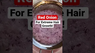 RED ONION JUICE FOR EXTREME HAIR GROWTH! Prevent Dandruff, #SEBORRHEICDERMATITIS  #ONIONJUICE #4C