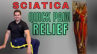 30 Second Sciatica Relief (ONE MUST DO Movement) {BONUS} Stretch for Sciatic Nerve